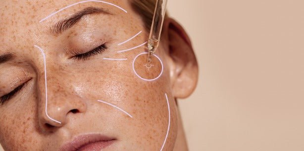 Pourquoi est-il important de faire un diagnostic de peau ? - Novëm