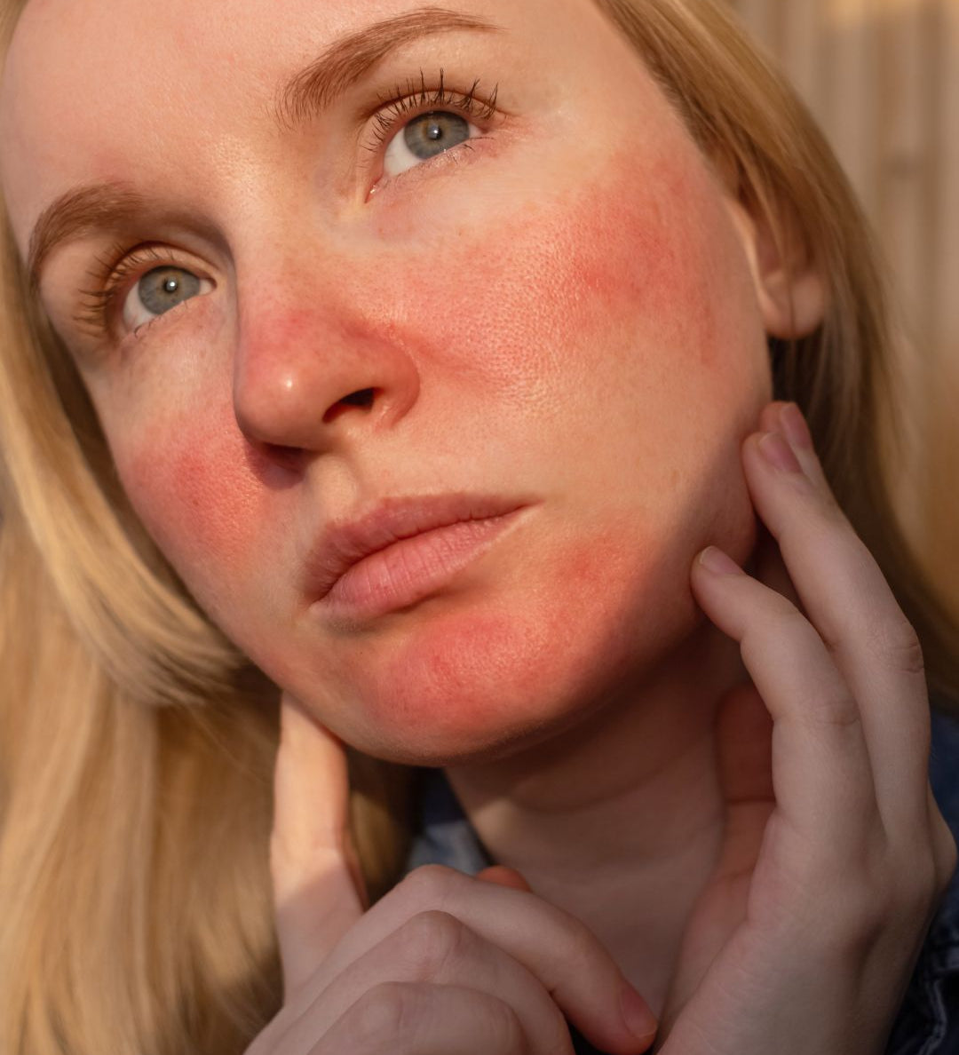 Femme appliquant un soin naturel pour diminuer les rougeurs de la rosacée et de la couperose sur les joues.