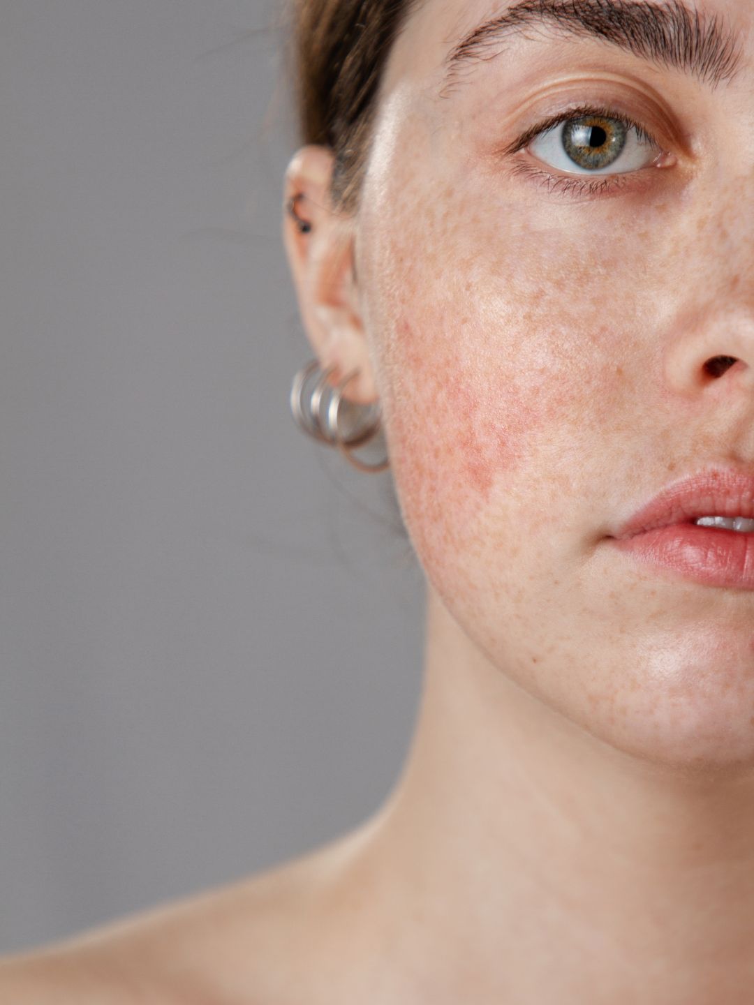 Gros plan sur une peau apaisée et hydratée avec une texture de crème onctueuse protectrice.