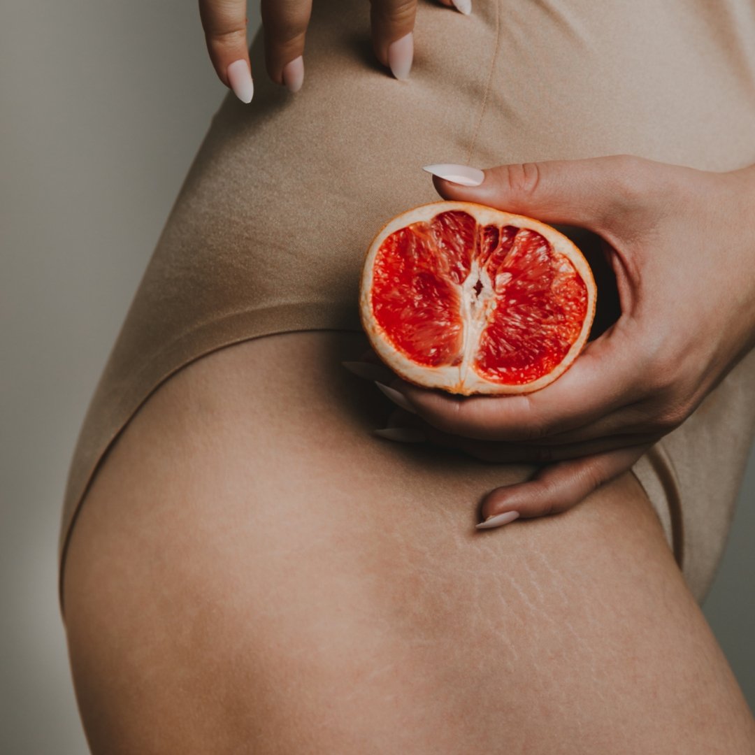 Comprendre les types de cellulite et découvrir des conseils efficaces pour la réduire - Novëm