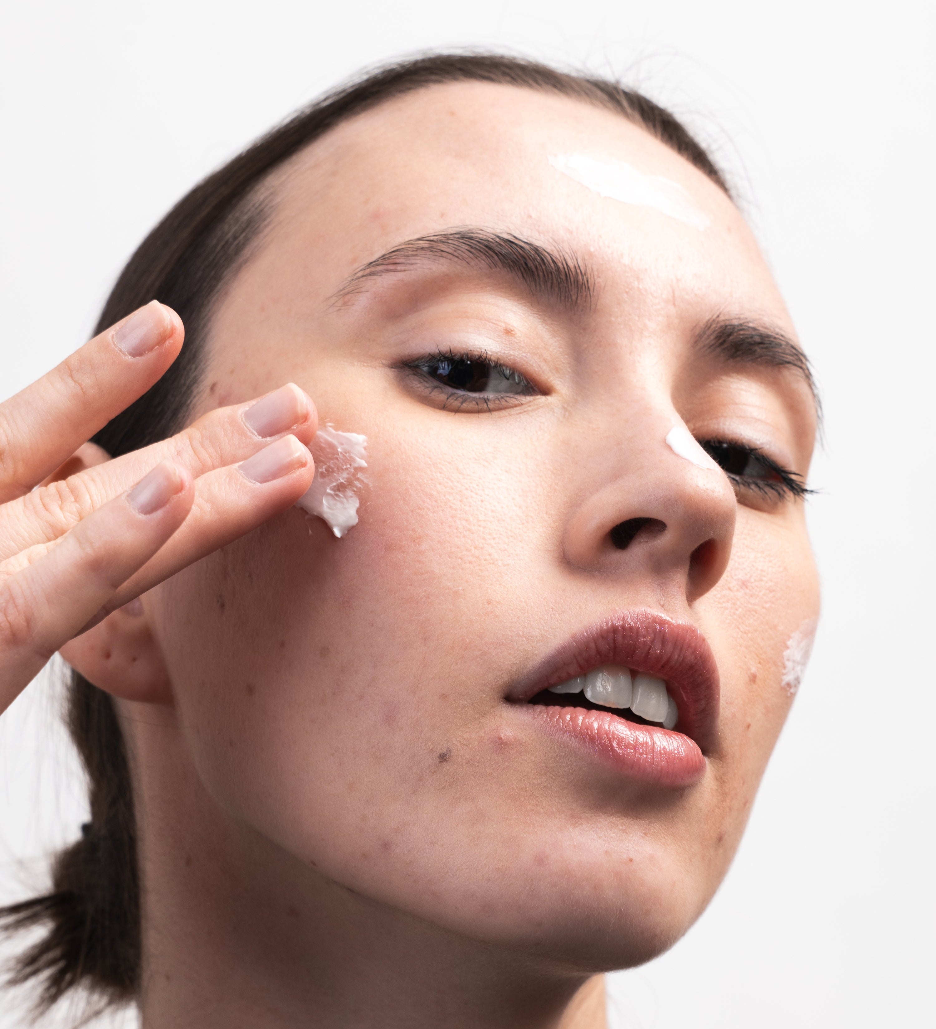 Peau sèche en hiver : quelles solutions vraiment efficaces ?