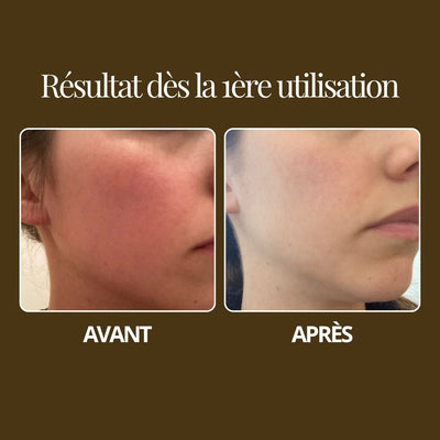 Routine visage complète peau sensible