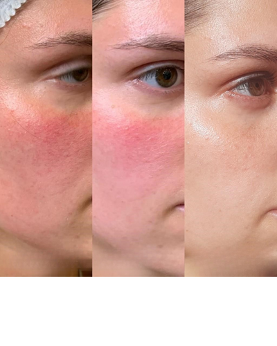 Rituel Complet Jour & Nuit – Éclat & Réparation
