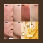 Soothing oil - anti-redness