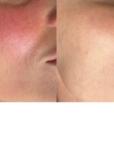Rituel Complet Jour & Nuit – Éclat & Réparation