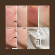 Routine Peau Sensible Fermeté