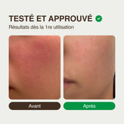 Crème Hydratante Visage Peaux Sensibles à l'Huile de Noix