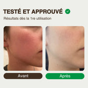 Soothing oil - anti-redness