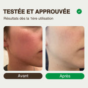 Soothing oil - anti-redness