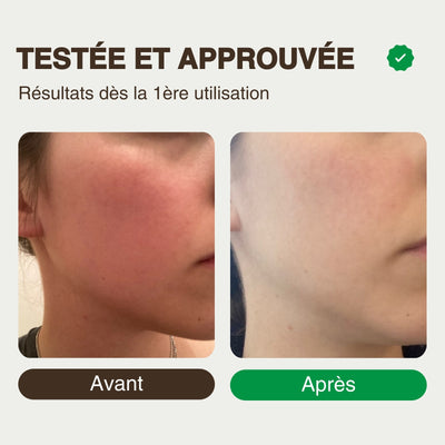 Crème visage anti-rougeurs